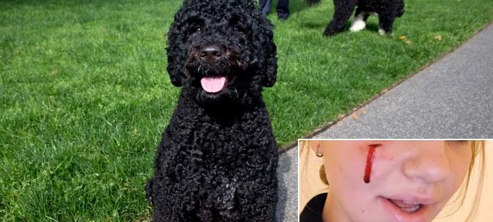 Ο σκύλος του Ομπάμα δάγκωσε στο πρόσωπο 18χρονη
